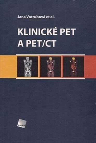 Klinické PET a PET/CT – Jana Votrubová