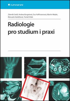 Radiologie pro studium i praxi – Zdeněk Seidl, Manuela Vaněčková, Andrea Burgetová, Eva Hoffmannová, Martin Mašek, Tomáš Viták