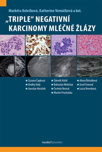 „Triple“ negativní karcinomy mléčné žlázy – Katherine Vomáčková, Markéta Kolečková