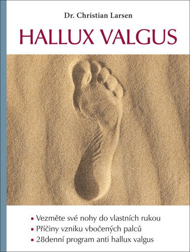 Hallux valgus – Christian Larsen
