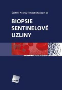 Biopsie sentinelové uzliny - Čestmír Neoral; Tomáš Bohanes
