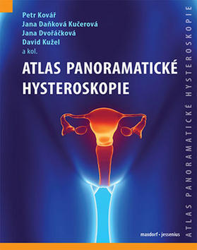 Atlas panoramatické hysteroskopie - Petr Kovář; Jana Daňková Kučerová; Jana Dvořáčková