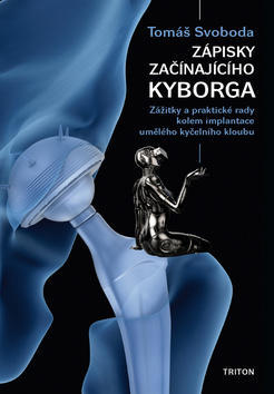 Zápisky začínajícího kyborga - Zážitky a praktické rady kolem implantace umělého kyčelního kloubu - Tomáš Svoboda