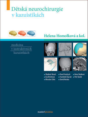 Dětská neurochirurgie v kazuistikách - Helena Homolková