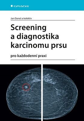 Screening a diagnostika karcinomu prsu - pro každodenní praxi - Jan Daneš