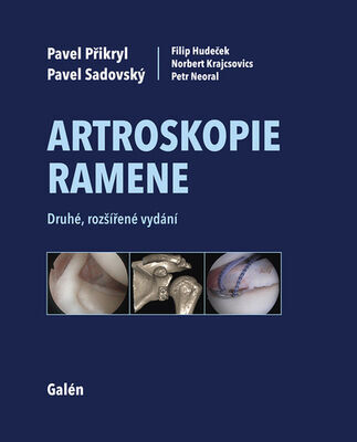 Artroskopie ramene - Pavel Přikryl; Pavel Sadovský; Filip Hudeček