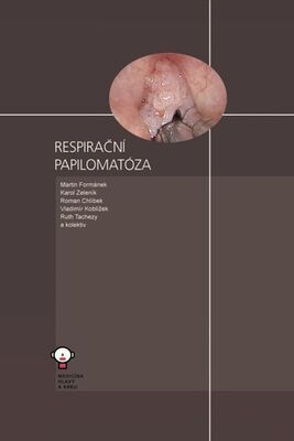 Respirační papilomatóza - Martin Formánek; Karol Zeleník; Roman Chlíbek